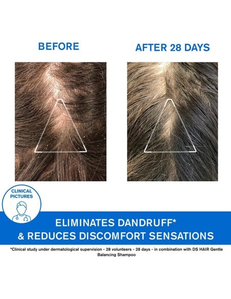 Ds Champu Tratante Anticaspa 200Ml. de Uriage