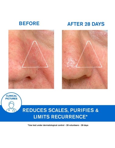 Ds Emulsion Corporal-Capilar Piel Escamada 40Ml. de Uriage